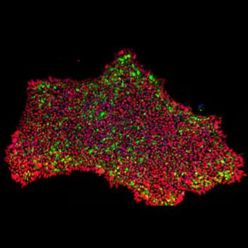 Nuevo método para transformar células de la piel en células madre pluripotentes
