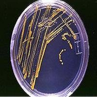 DEFINICION DE MICROBIOLOGIA