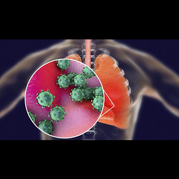 Coronavirus: ¿por qué no se han reportado casos afirmativos en América Latina?