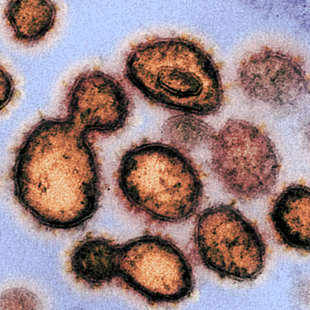 La OMS lanza el megatrial global de los cuatro tratamientos de coronavirus más prometedores