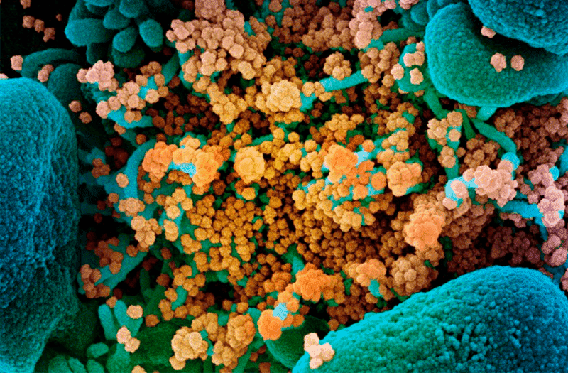 Seis meses de coronavirus: los misterios que los científicos aún están luchando por resolver