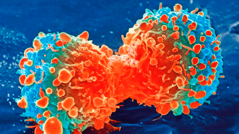 Avances en la investigación del cáncer de mama y ovario con microscopía crioelectrónica