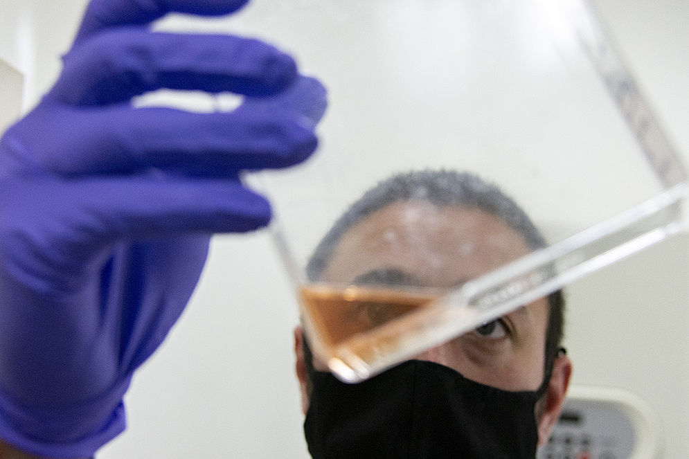 csm_4_Tuberculosis_BP_84a9dc6faf